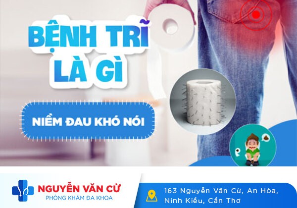 Bệnh trĩ, dấu hiệu bệnh trĩ và cách điều trị hiệu quả