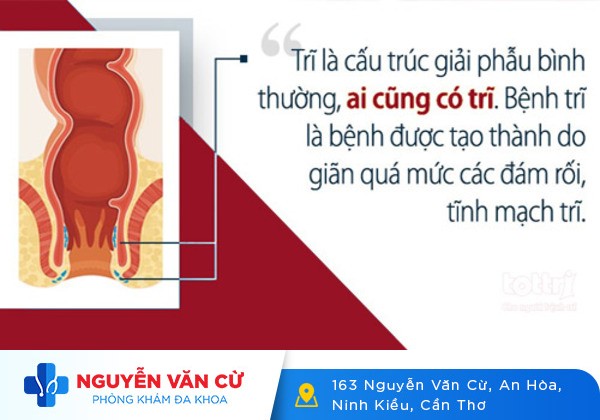 Bệnh trĩ từ A đến Z: Tất tần tật thông tin mà bạn cần biết