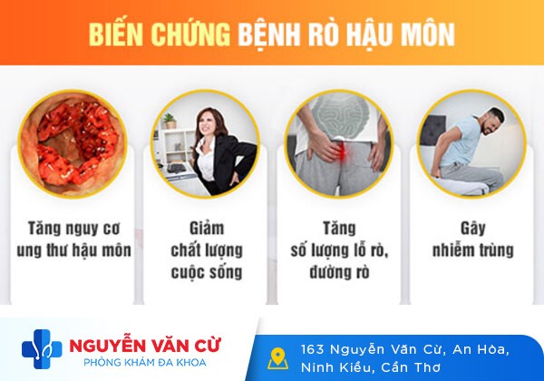 Chi Phí Mổ Rò Hậu Môn Là Bao Nhiêu?
