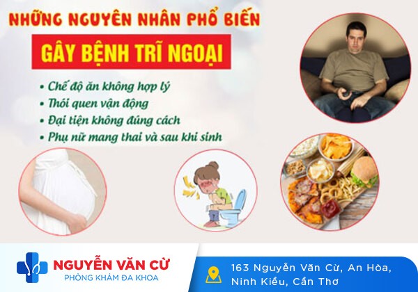 Bệnh trĩ ngoại và những điều cần biết