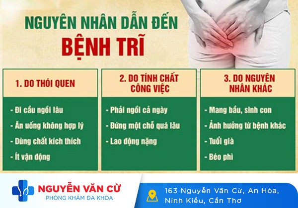 Phòng khám bệnh trĩ tại Cần Thơ uy tín hiệu quả