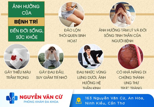 Cắt trĩ an toàn không đau tại Đa khoa Nguyễn Văn Cừ