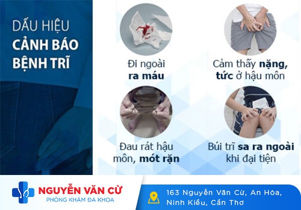 Những Thông Tin Nên Biết Về Bệnh Nứt Hậu Môn