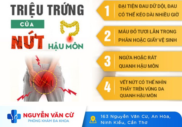 Nứt Kẻ Hậu Môn – Căn Bệnh Nguy Hiểm Cần Được Điều Trị Ngay