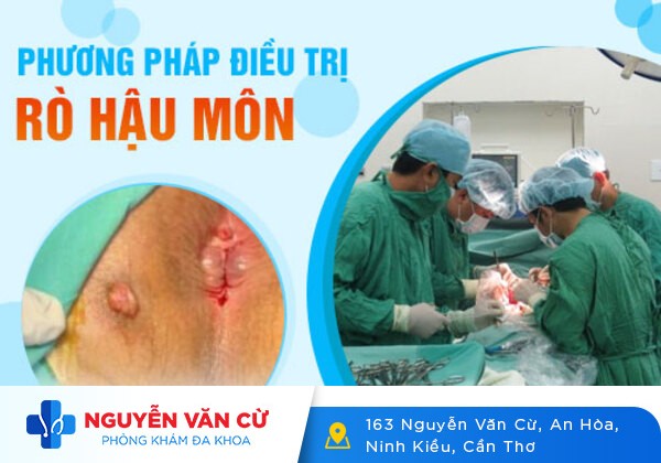 Điều trị rò hậu môn bằng công nghệ tiên tiến, an toàn, chi phí hợp lý
