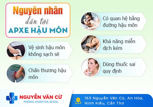Áp xe hậu môn chữa có nhanh khỏi không?