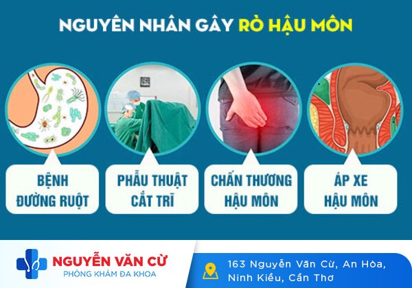 Hốt hoảng tìm gặp bác sĩ vì bị bệnh mạch lươn
