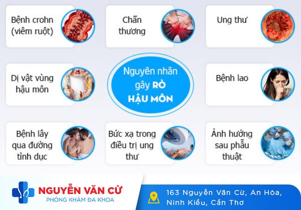 6 biểu hiện và dấu hiệu nhận biết bệnh rò hậu môn không nên bỏ qua