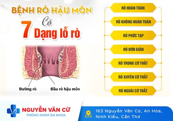 Rò hậu môn là bệnh gì? Các triệu chứng và cách điều trị hiệu quả