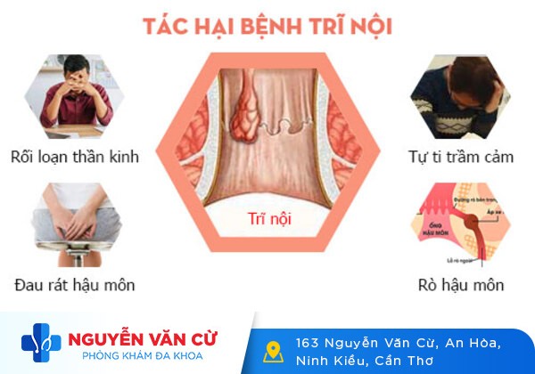 Cần Phải Làm Gì Khi Mắc Bệnh Trĩ Nội