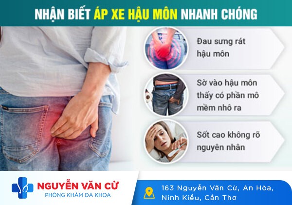 Áp Xe Hậu Môn Và Cách Điều Trị Hiệu Qủa