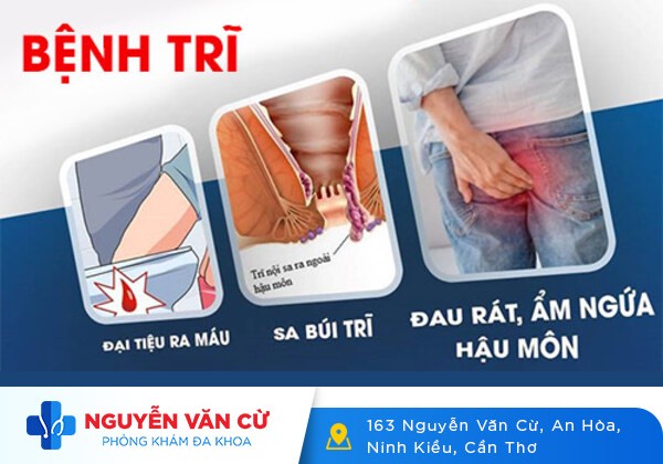 Chữa đau hậu môn an toàn