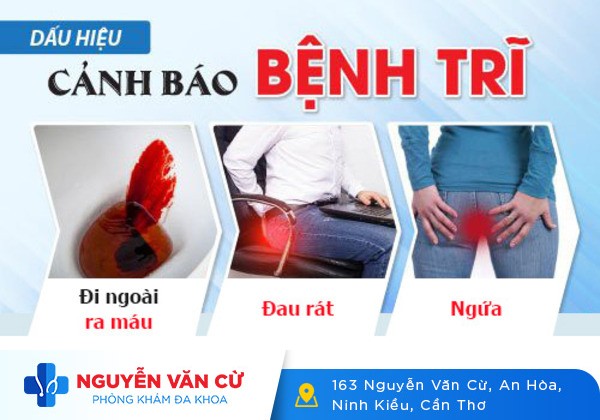 Điều trị bệnh trĩ đúng cách bạn đã biết chưa?