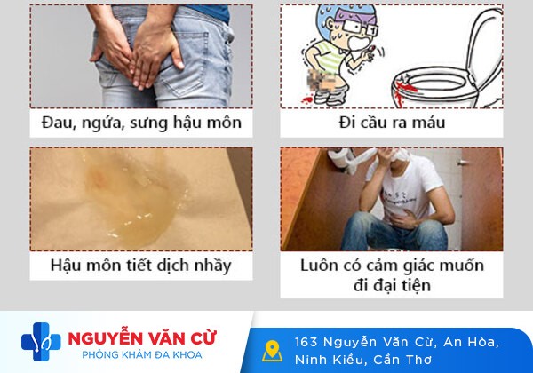 Đi ngoài đau rát hậu môn là bệnh gì?