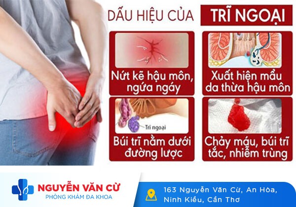 Bị lòi con trê phải làm sao?