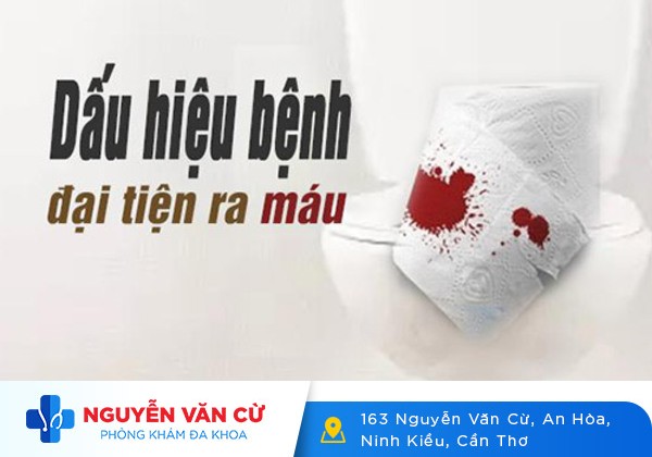 Chữa đi cầu ra máu không còn là vấn đề khó