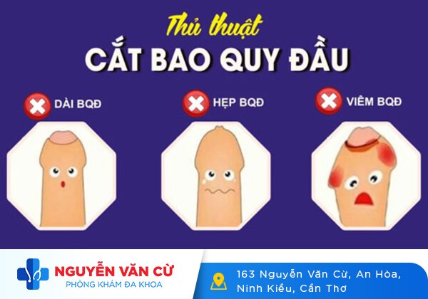 Phòng khám cắt bao quy đầu ngoài giờ, chất lượng tại Cần Thơ