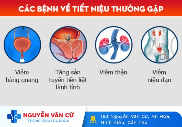 Khám tiết niệu là khám những gì?