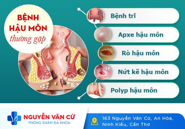 Tại Sao Đi Cầu Bị Nóng Rát Hậu Môn? Dấu Hiệu Nhiều Người Xem Nhẹ