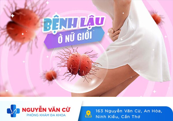 Những Thông Tin Cần Biết Về Bệnh Lậu Ở Nữ Giới