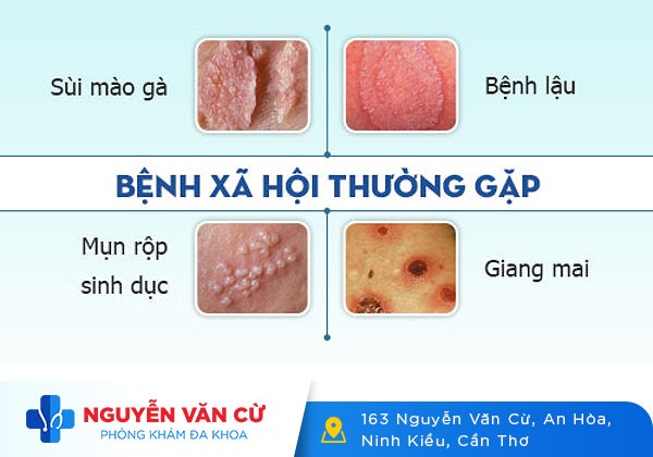 Bệnh Viện Chữa Bệnh Hoa Liễu Uy Tín Tại Cần Thơ