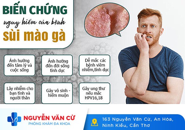 Dương vật Nổi Mụn Đỏ – Cẩn Thận Bạn Đã Mắc Bệnh Hoa Liễu