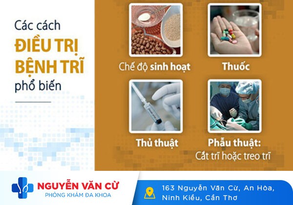Những phương pháp điều trị bệnh trĩ hiệu quả hiện nay
