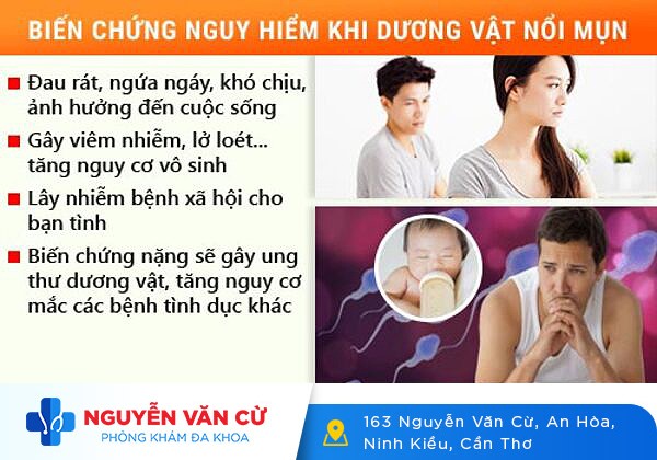 Nổi Mụn Thịt Ở Bìu Tinh Hoàn Là Dấu Hiệu Bệnh Gì?
