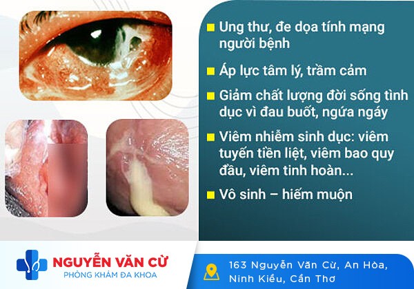 Hối hận khi không thể có con vì trót “đổi gió”, đi khám mới biết mắc bệnh lậu ở nam