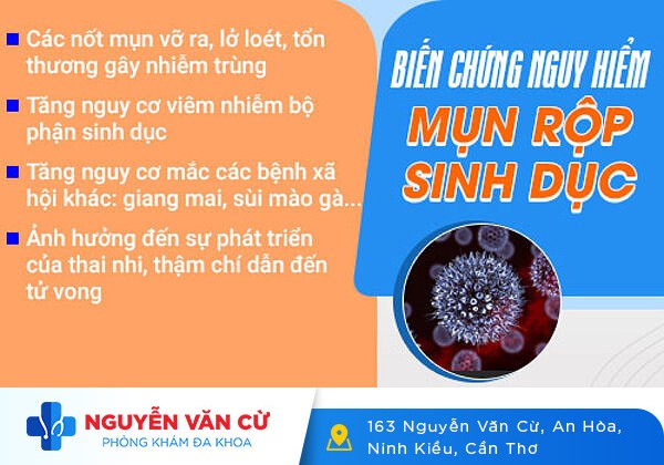Cách Chữa Trị Mụn Rộp Sinh Dục Tại Nhà Nhanh Chóng Hiệu Quả