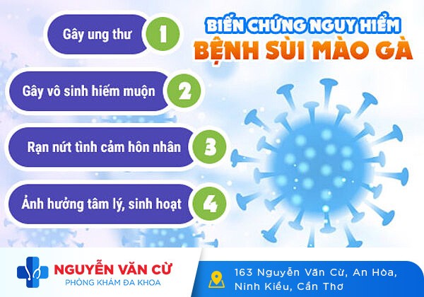 Sùi mào gà – Bệnh dễ lây nhiễm nhưng khó điều trị