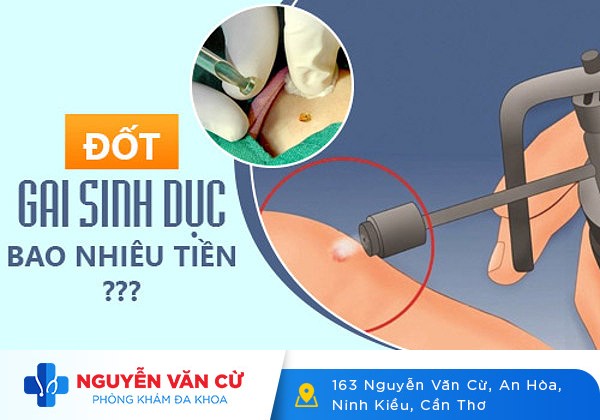 Đốt gai sinh dục bao nhiêu tiền? Đốt ở đâu giá rẻ, an toàn?
