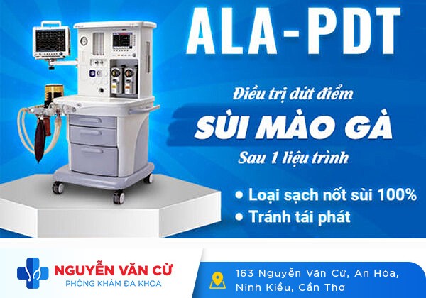 Chữa bệnh sùi mào gà bằng phương pháp nào hiệu quả nhất?