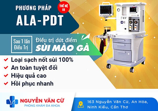Hỗ trợ điều trị sùi mào gà hiệu quả với phương pháp đốt điện cải tiến mới