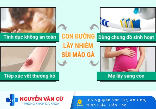 Sùi mào gà – căn bệnh dễ lây nhưng khó điều trị