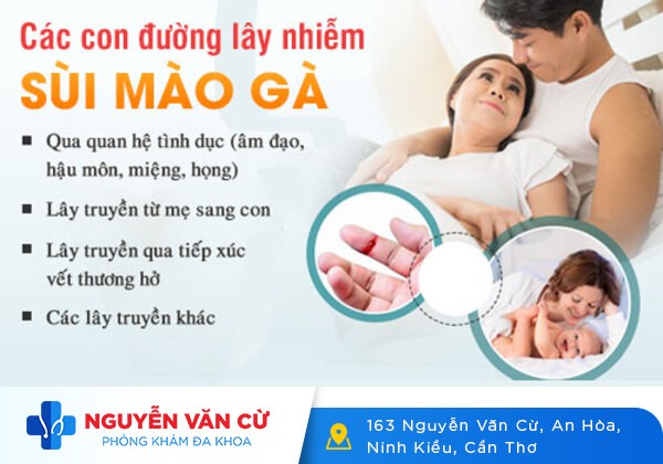 Cảnh báo nguy hiểm từ bệnh sùi mào gà ở nam giới