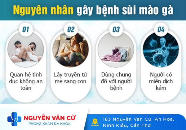 Các lý do bị sùi mào gà phổ biến bạn cần biết để phòng tránh