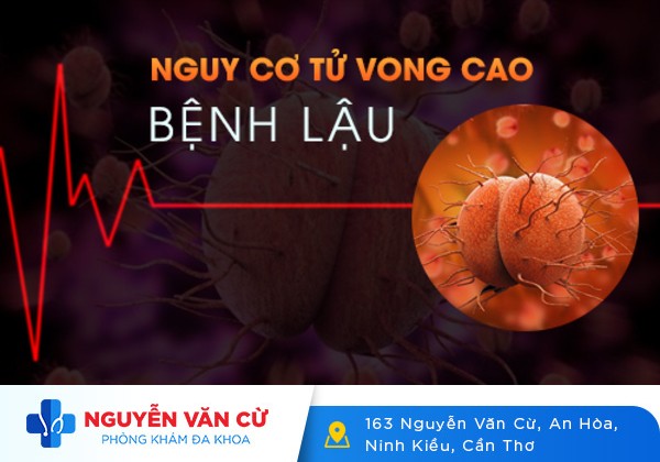 Nguy cơ tử vong cao khi mắc bệnh lậu mãn tính