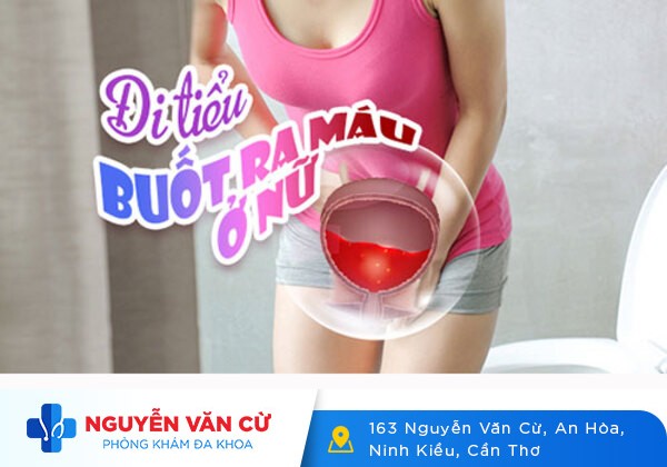 Đừng Chủ Quan Với Bệnh Tiểu Buốt