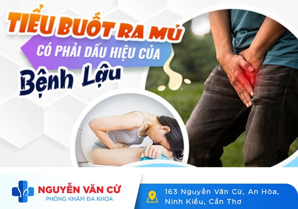 Tiểu Buốt Có Phải Dấu Hiệu Của Bệnh Lậu Không?
