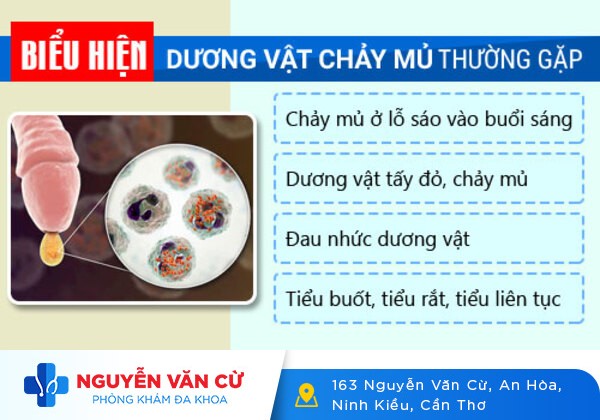 Kiểm Tra Và Điều Trị Dương Vật Chảy Mủ