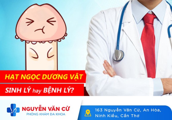 Chuỗi hạt ngọc dương vật và cách trị