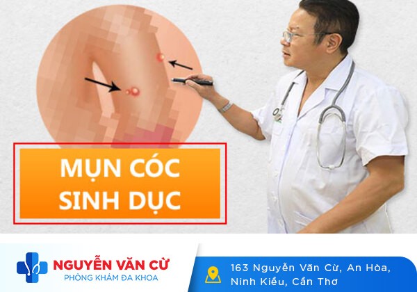 Mụn cóc ở dương vật có nguy hiểm không?