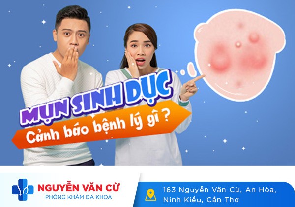 Không nên chủ quan với bệnh mụn sinh dục