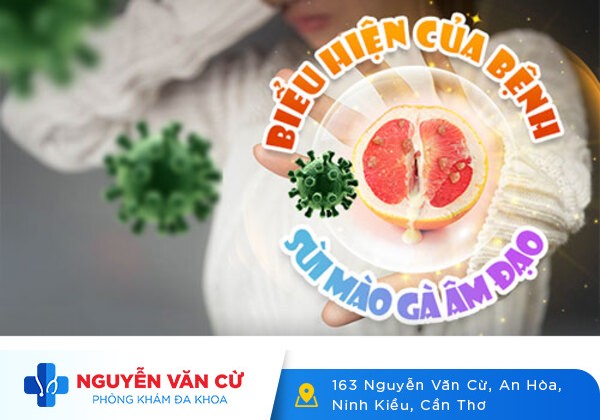 Sùi Mào Gà Ở Âm Đạo: Nỗi Ám Ảnh Và Lo Sợ Của Nhiều Người