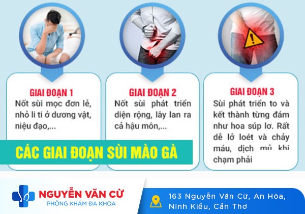 Thời gian ủ bệnh sùi mào gà là bao lâu? Biểu hiện sùi mào gà thời kỳ ủ bệnh