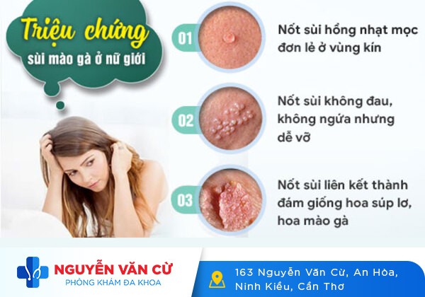 Mụn Bộ Phận Sinh Dục Là Dấu Hiệu Bệnh Gì?