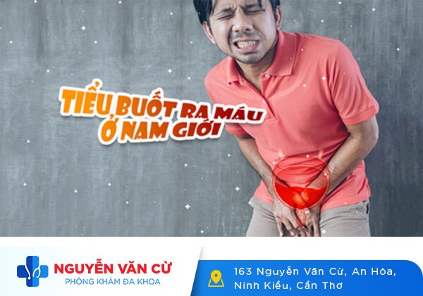 Cách Điều Trị Tiểu Buốt Hiệu Quả