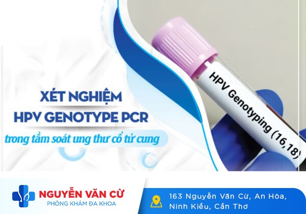 Cách Test Bệnh Sùi Mào Gà Nhanh Chóng Tại Nhà