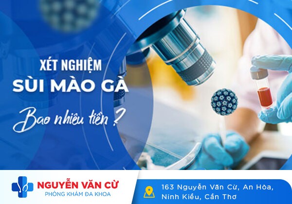 Chi Phí Xét Nghiệm Sùi Mào Gà Là Bao Nhiêu